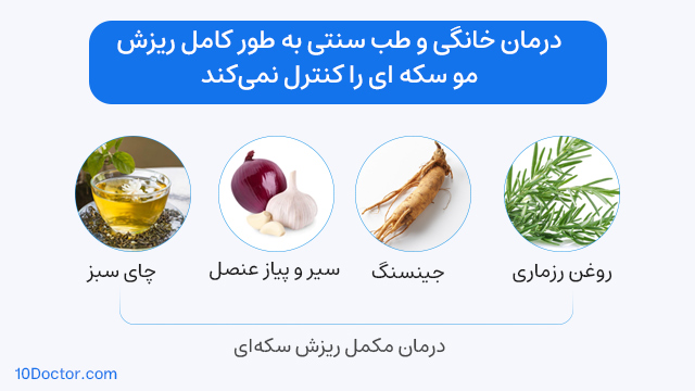 درمان خانگی و طب سنتی به طور کامل ریزش مو سکه ای را کنترل نمیکند.