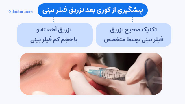 پیشگیری از کوری بعد تزریق فیلر بینی
