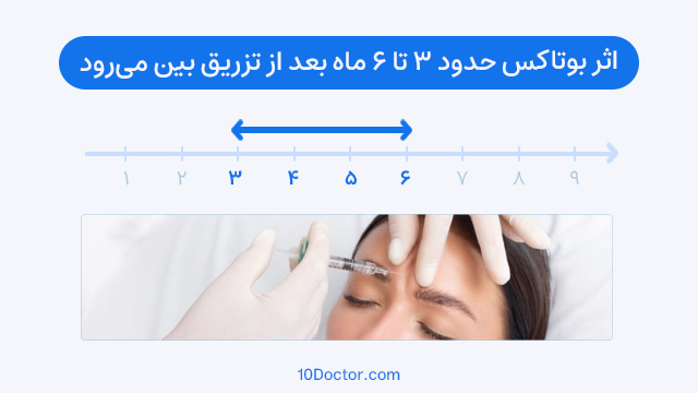 اثر بوتاکس حدود 3 تا 6 ماه بعد از تزریق بین میرود.