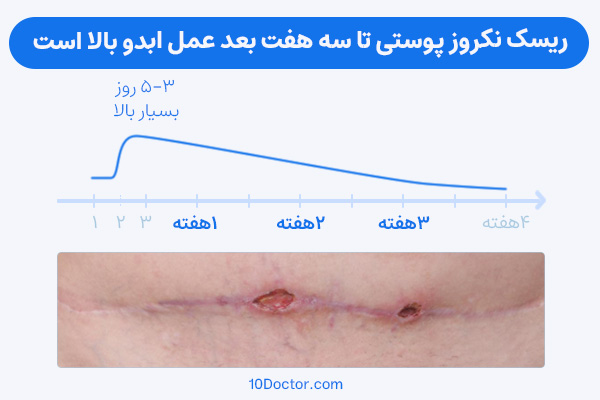 ریسک نکروز پوستی تا سه هفته بعد عمل ابدو بالا است.