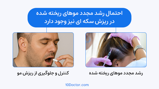 احتمال رشد مجدد موهای ریخته شده در ریزش سکه ای نیز وجود دارد.