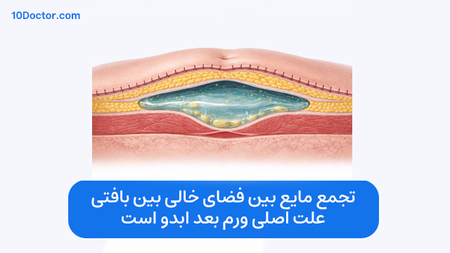 تجمع مایع بین فضای خالی بین بافتی، علت اصلی ورم بعد ابدو است.