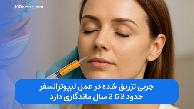 چربی تزریق شده در عمل لیپوترانسفر حدود 2 تا 3 سال ماندگاری دارد.