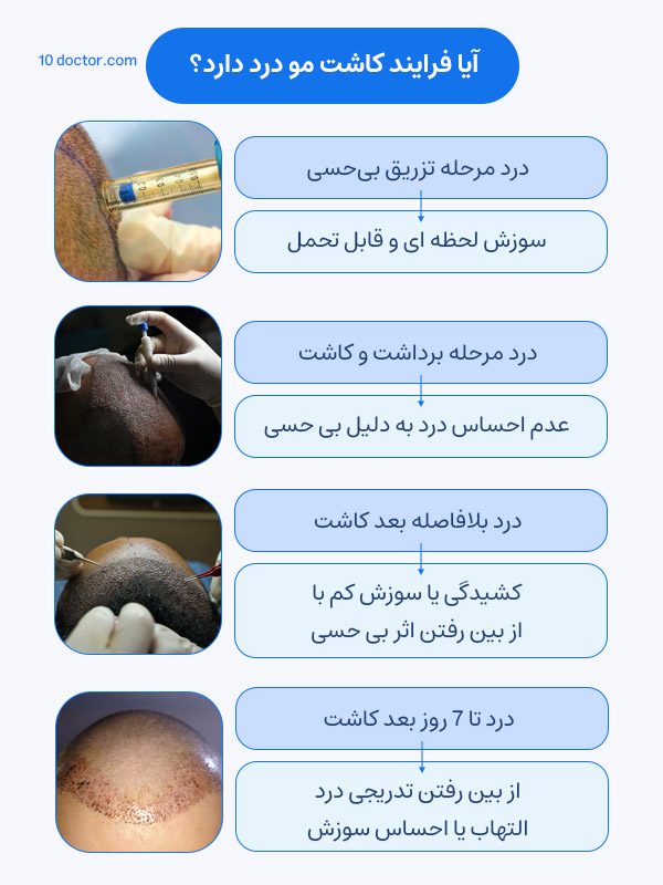 آیا فرایند کاشت مو درد دارد؟