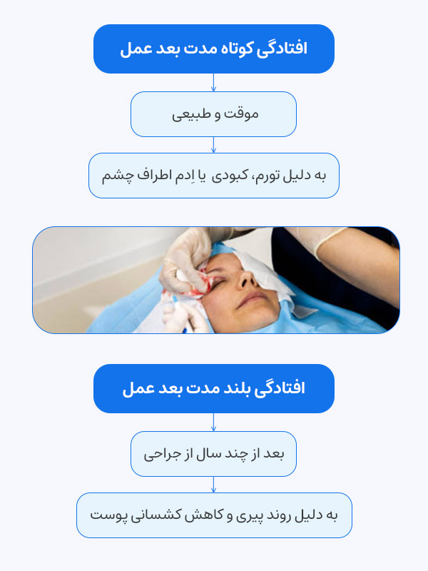 برگشت افتادگی بعد از بلفارو
