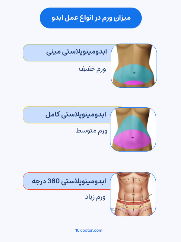میزان ورم در انواع عمل ابدو
