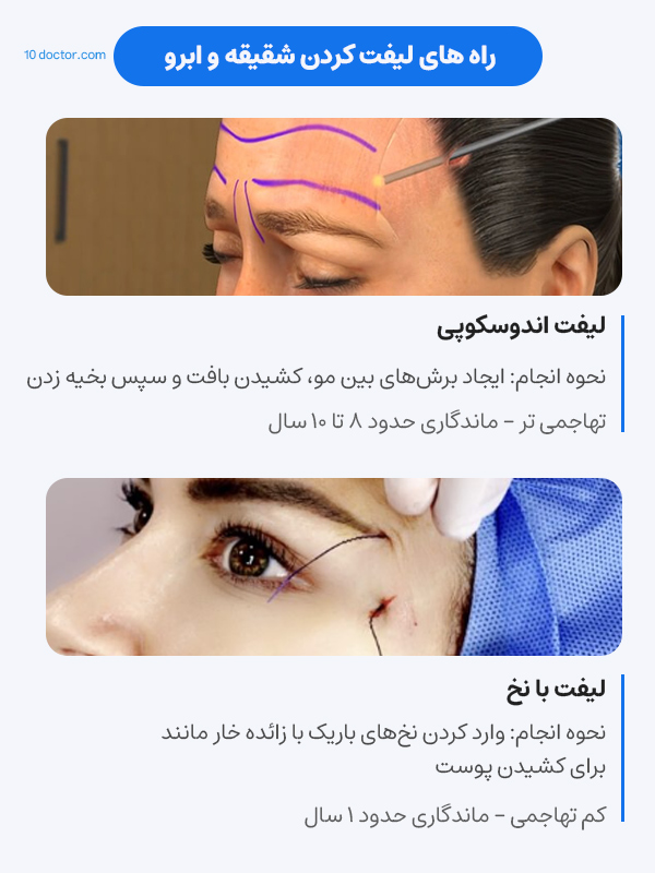 راه های لیفت کردن شقیقه و ابرو