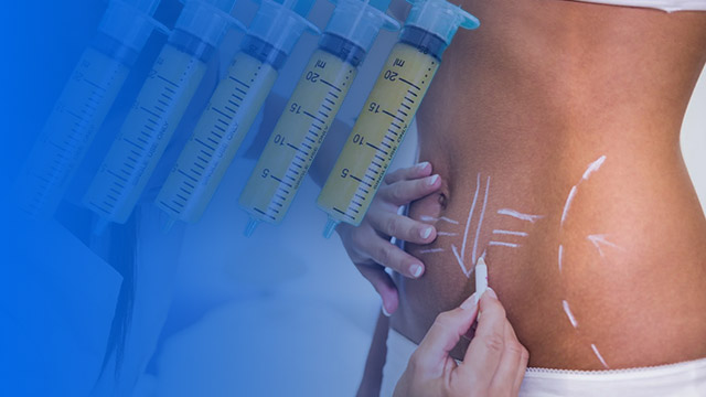 لیپوماتیک ترانسفر چیست؟