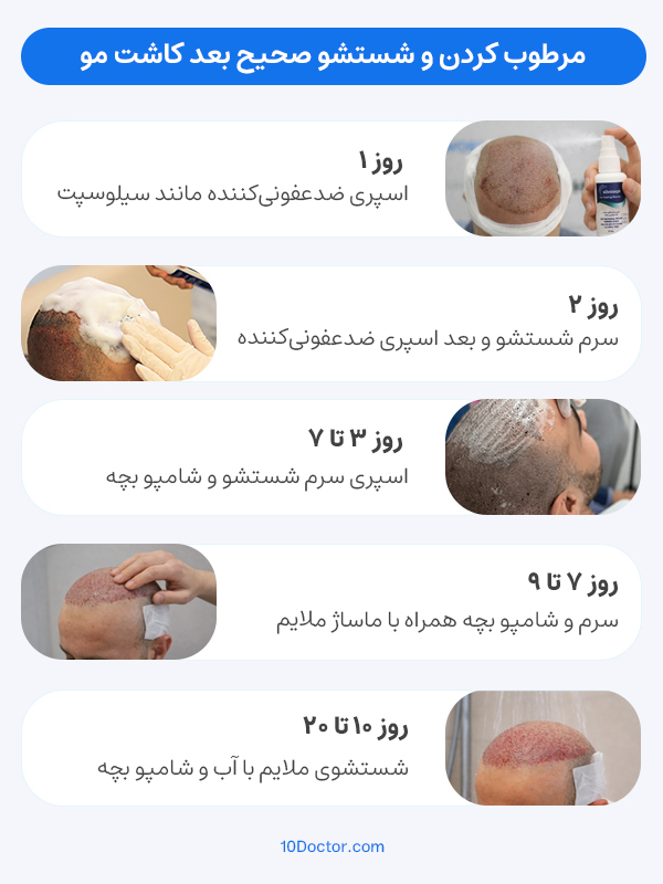  مرطوب کردن و شستشو صحیح بعد کاشت مو