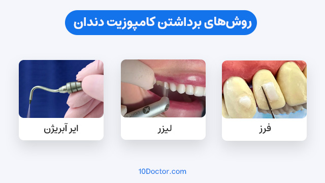 روش‌های برداشتن کامپوزیت دندان