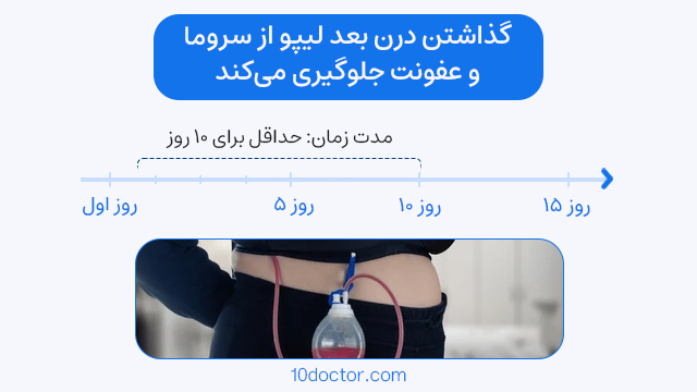 گذاشتن درن بعد لیپو از سروما و عفونت جلوگیری می‌کند. 