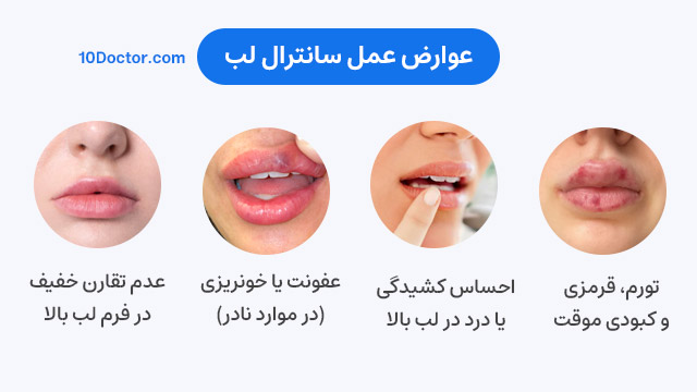 عوارض عمل سانترال لب