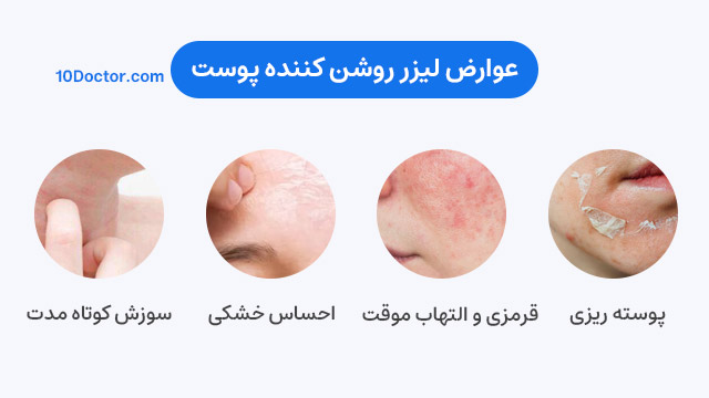 عوارض لیزر روشن کننده پوست