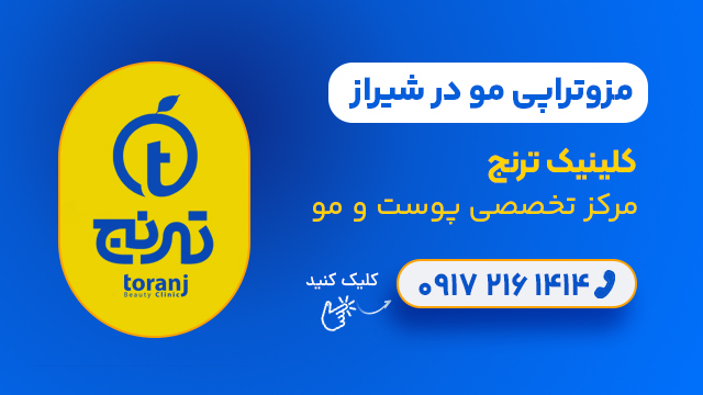 مزوتراپی مو در شیراز - کلینیک ترنج