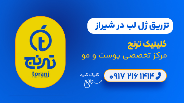 تزریق ژل لب در شیراز - کلینیک ترنج
