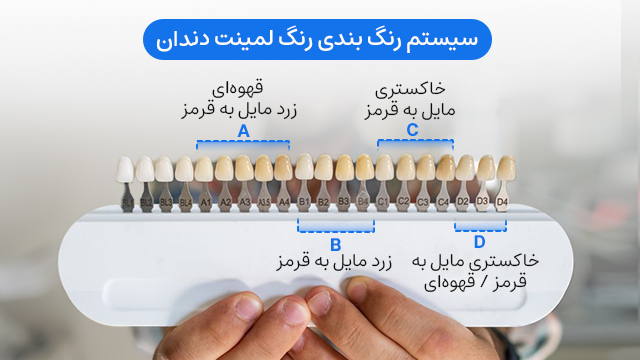 سیستم رنگ بندی رنگ لمینت دندان 