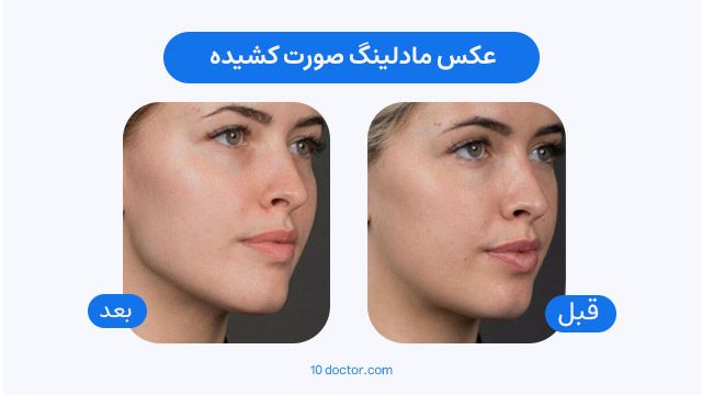 عکس مادلینگ صورت کشیده