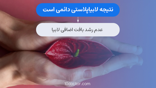 عمل لابیاپلاستی معمولا با بی حسی موضعی انجام میشود.