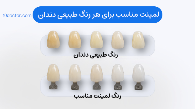 لمینت مناسب برای هر رنگ طبیعی دندان