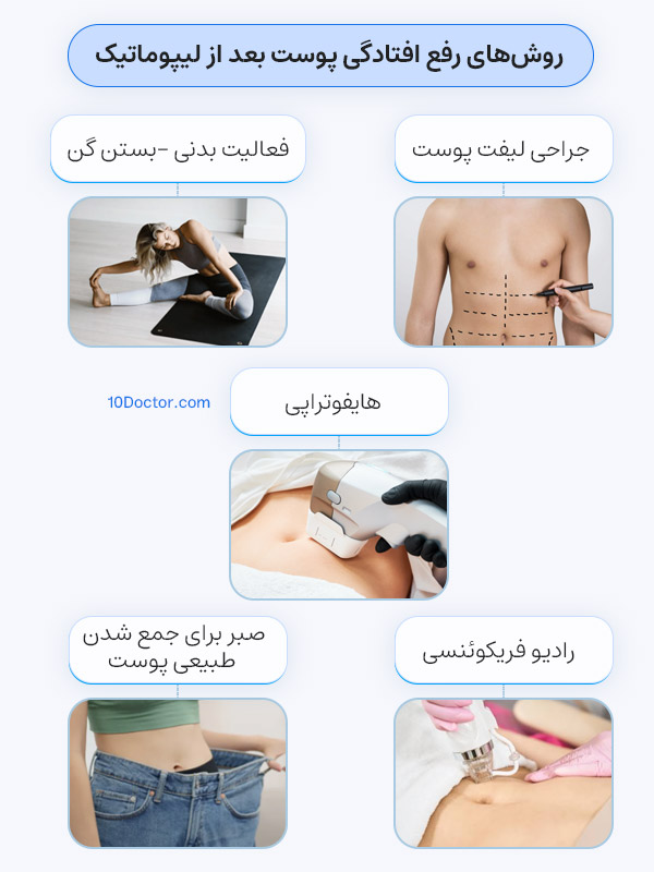 روش‌های رفع افتادگی پوست بعد از لیپوماتیک
