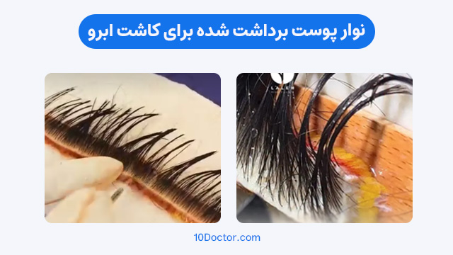 نوار پوست برداشت شده برای کاشت ابرو