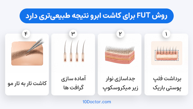 روش FUT برای کاشت ابرو نتیجه طبیعی‌تری دارد.