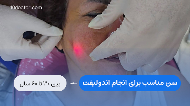 سن مناسب برای انجام اندولیفت
