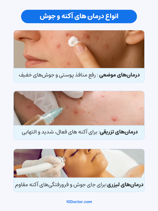 انواع درمان های آکنه و جوش