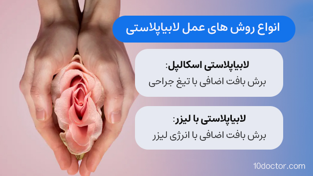 انواع روش های عمل لابیاپلاستی