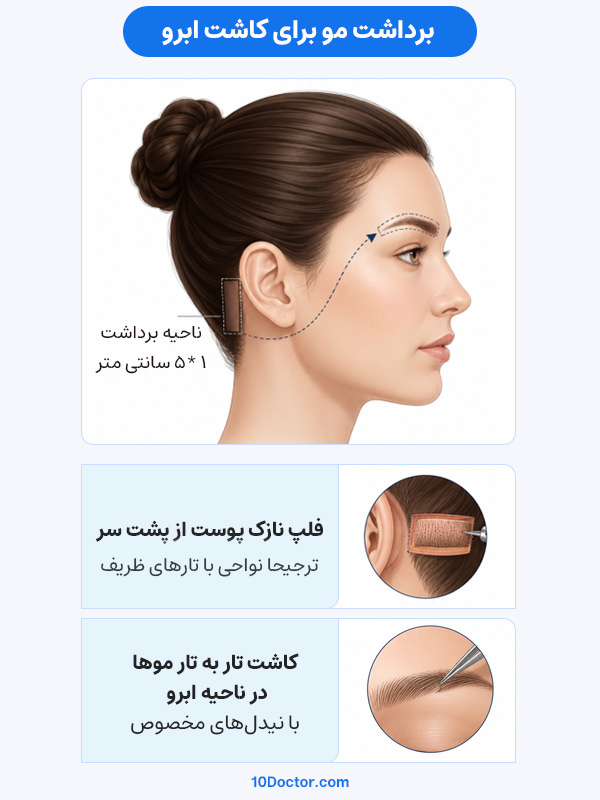 برداشت مو برای کاشت ابرو