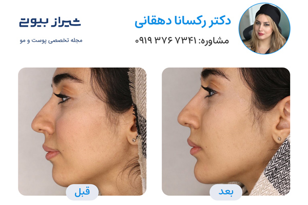 مادلینگ صورت در شیراز - دکتر رکسانا دهقانی