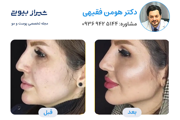 مادلینگ صورت در شیراز - دکتر هومن فقیهی