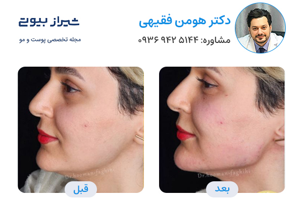 مادلینگ صورت در شیراز - دکتر هومن فقیهی