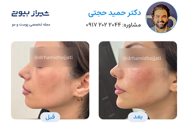 مادلینگ صورت در شیراز - دکتر حمید حجتی