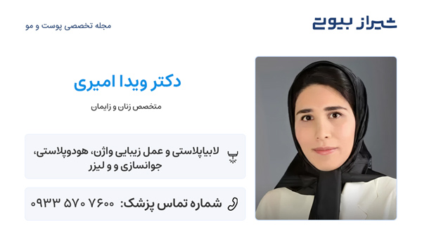 لابیاپلاستی در شیراز - دکتر ویدا امیری