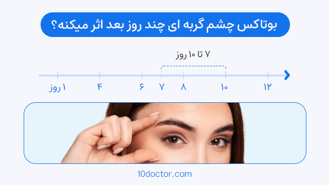 بوتاکس چشم گربه ای چند روز بعد اثر میکنه ؟