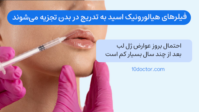 فیلرهای هیالورونیک اسید به تدریج در بدن تجزیه میشوند و احتمال بروز عوارض ژل لب بعد از چند سال بسیار کم است.