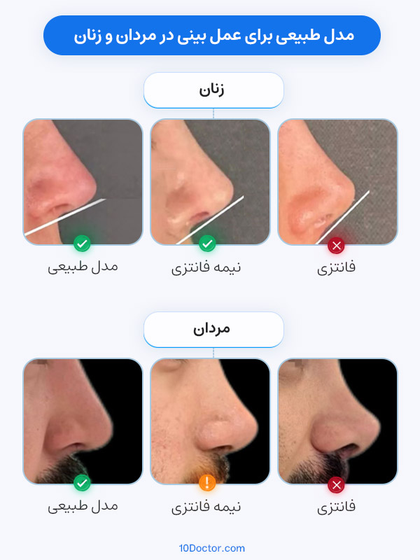 مدل طبیعی برای عمل بینی در مردان و زنان