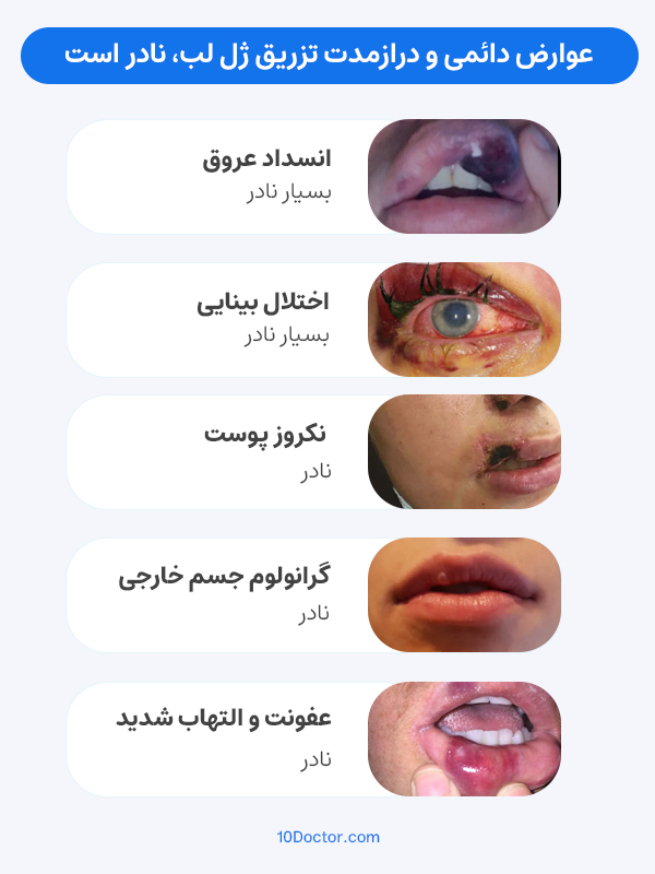 عوارض دائمی و درازمدت تزریق ژل لب، نادر است.