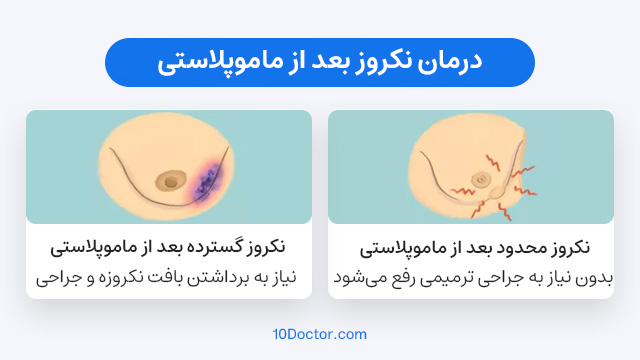 درمان نکروز بعد از ماموپلاستی