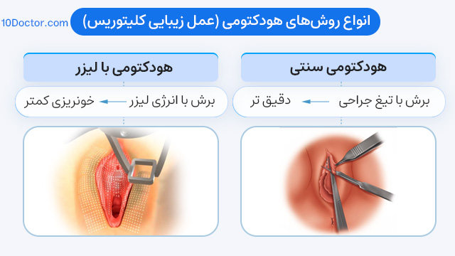 انواع روشهای هودکتومی (عمل زیبایی کلیتوریس)