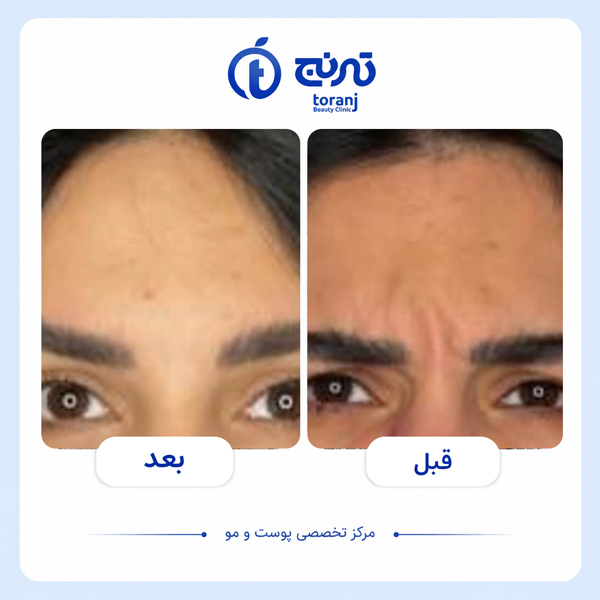 before after clinic toranj 10