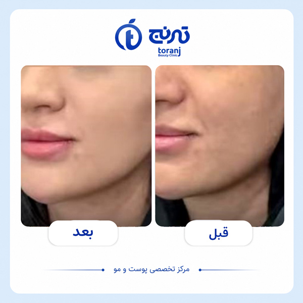 before after clinic toranj 7
