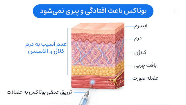 بوتاکس باعث افتادگی و پیری نمی‌شود. 
