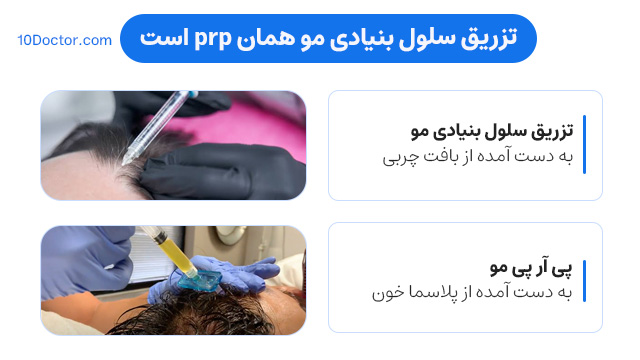 مقایسه تزریق سلول بنیادی مو با prp 