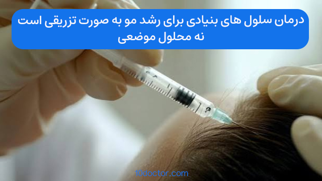 درمان سلول های بنیادی برای رشد مو به صورت تزریقی است نه محلول موضعی