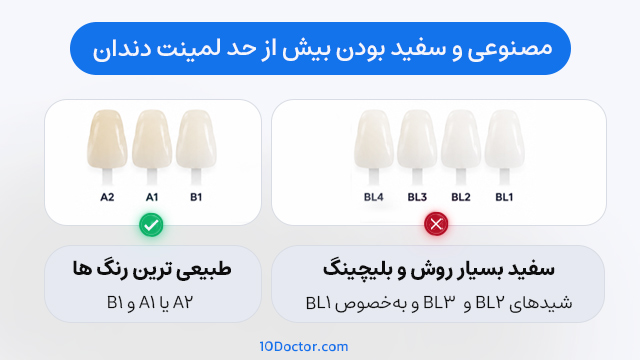مصنوعی و سفید بودن بیش از حد لمینت دندان