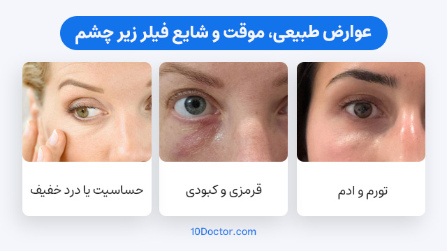 عوارض طبیعی، موقت و شایع فیلر زیر چشم