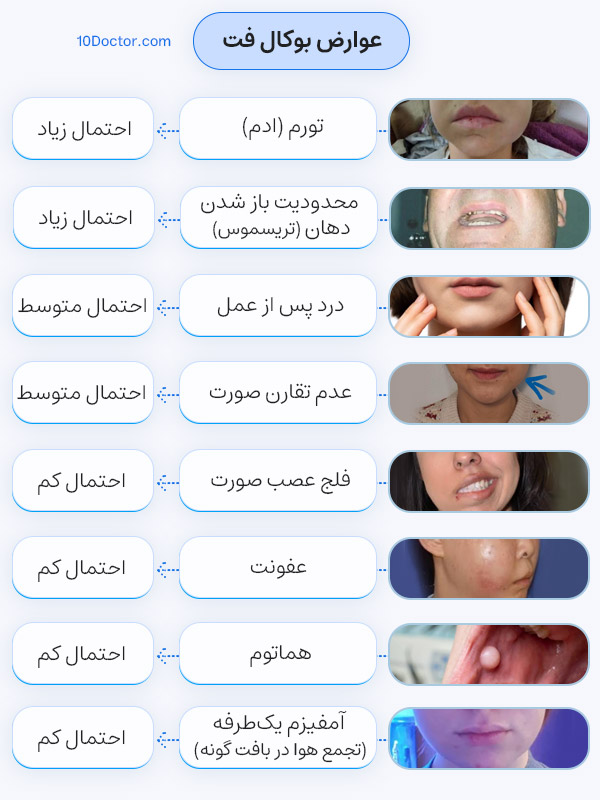 عوارض بوکال فت