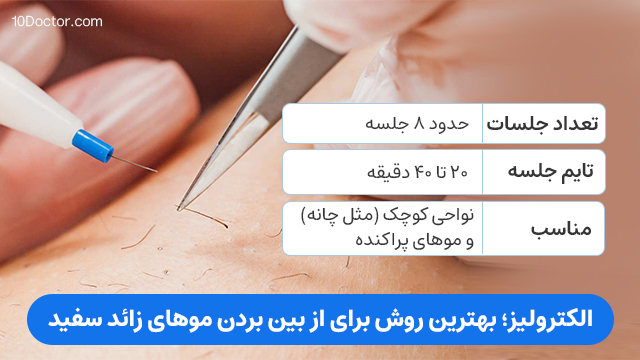 الکترولیز؛ بهترین روش برای از بین بردن موهای زائد سفید